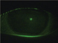 FLN-Fig-1-A-CIE.jpg