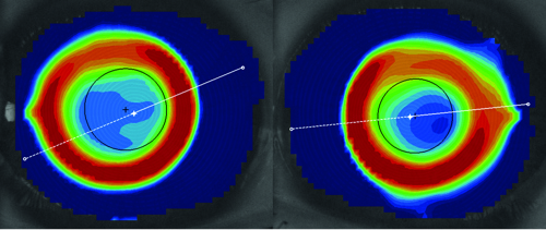 Figure 4: Topography for JG in 2018