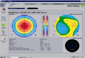 firmager 2 fig 1