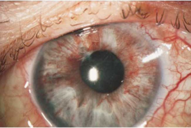 fig1 Systemic anterior eye adnexa