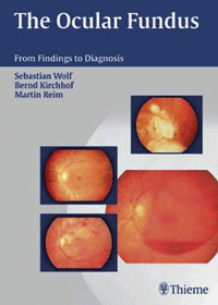 Ocular fundus