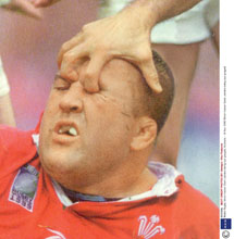 Eye gouging