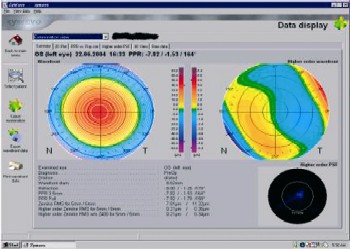 firmager 2 fig 2