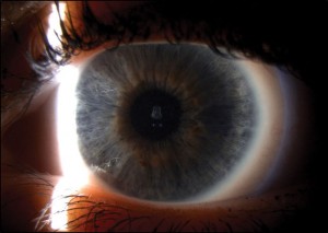 slit lamp